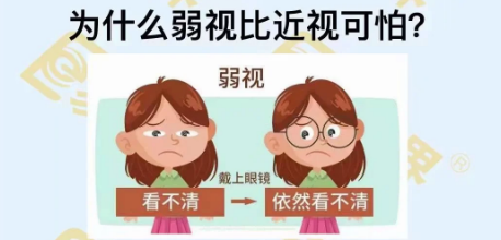為什么弱視比近視可怕？