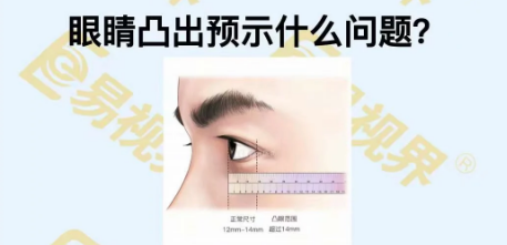 眼睛凸出預(yù)示著什么問題