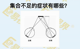 集合不足的癥狀有哪些？